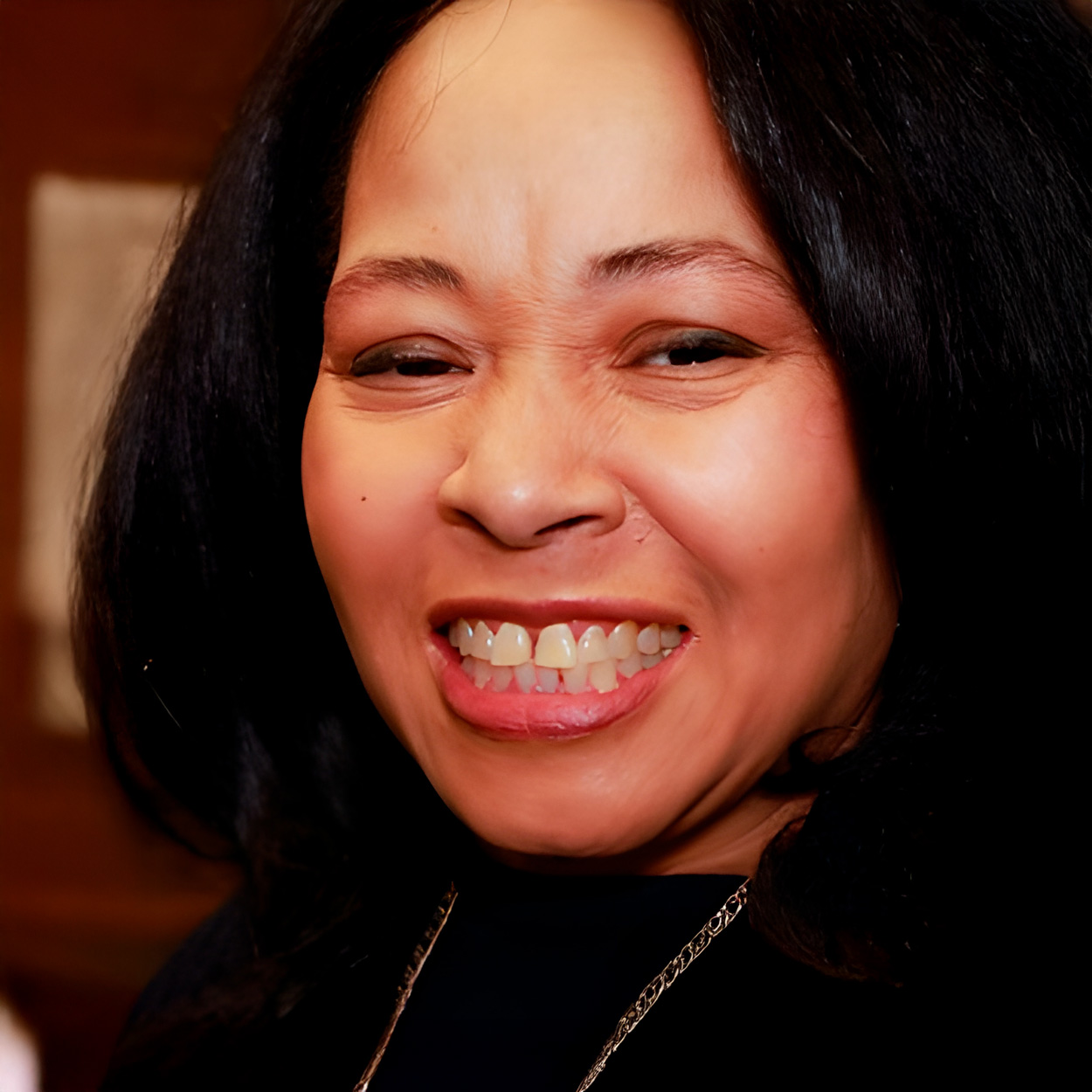Before using Shiny Smile snap-on veneers