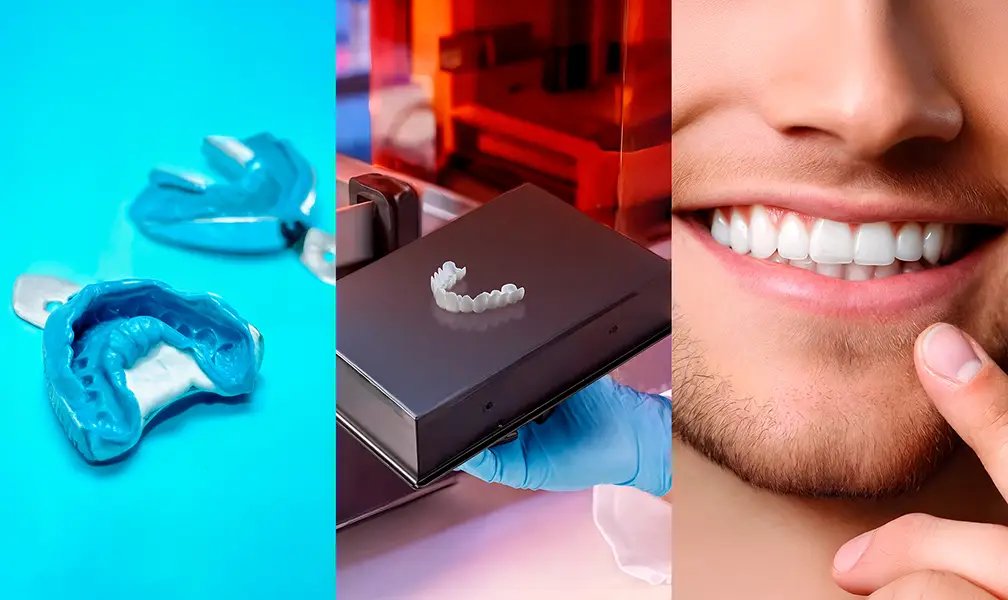 Snap-On Veneers